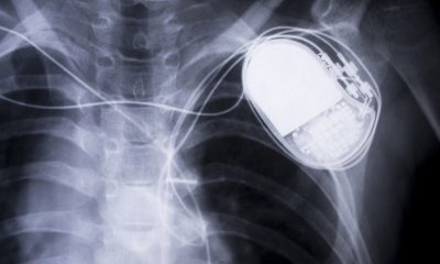 FDA: 465,000 Pacemakers need a firmware update